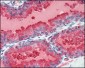 RET Antibody